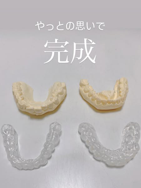 ホワイトニングって実は9